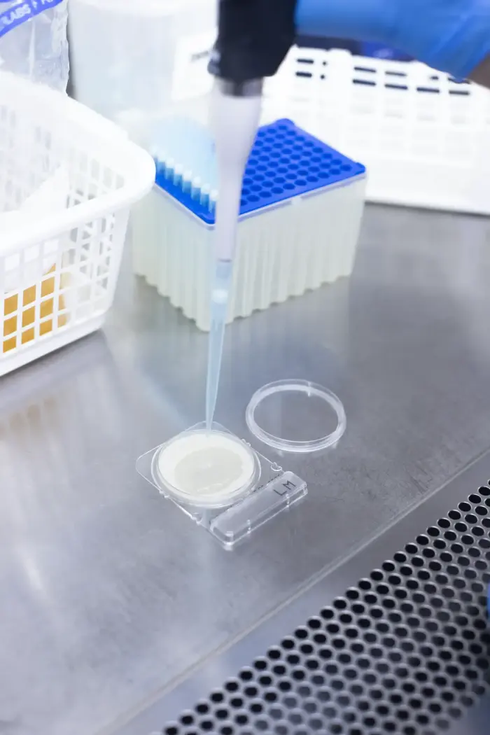 Paso 1: inoculación de muestra