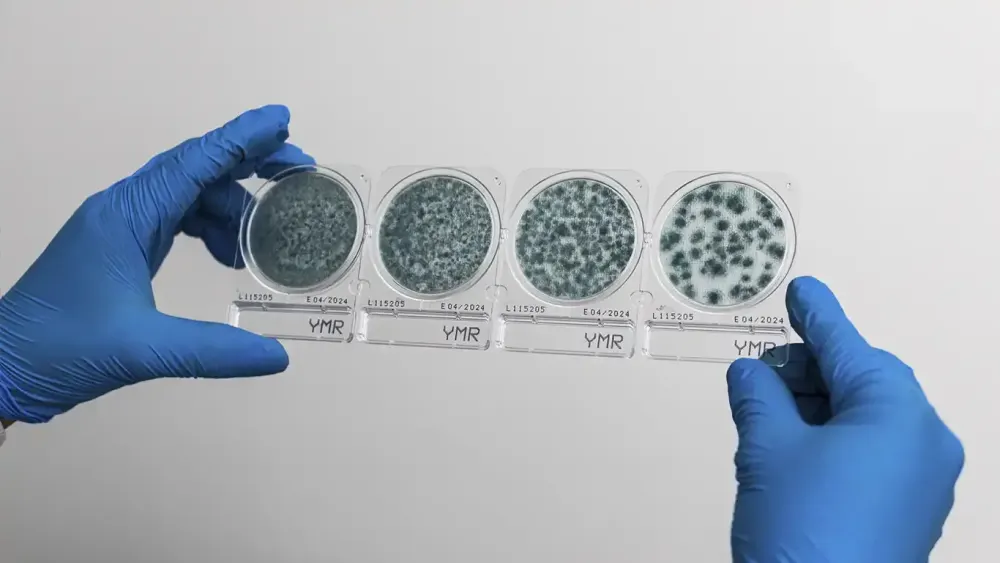 Placas de microbiología y novedades